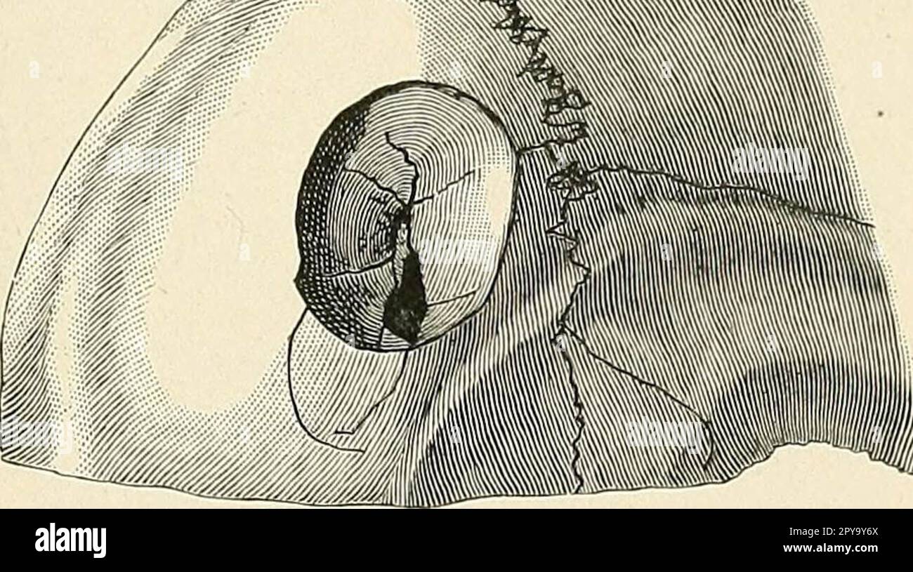 'Un livre de texte de premiers soins et de traitement d'urgence' (1917) Banque D'Images