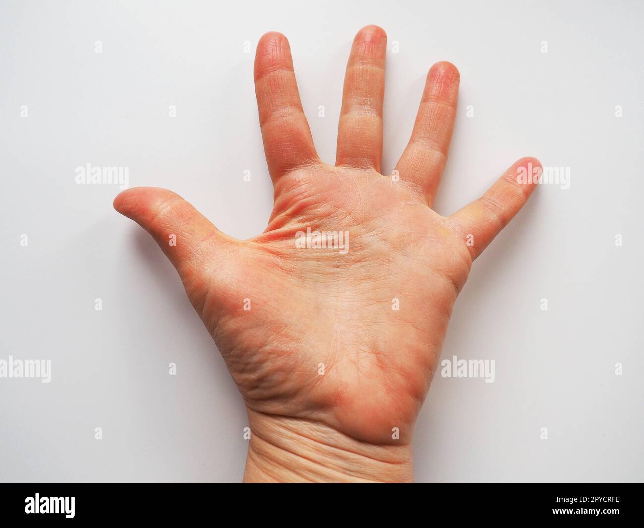 Paume de main sur fond blanc. Levez la paume de la main vers le spectateur. Signe de vote demandant de l'aide. Bonne chance sur les lignes dans la paume de votre main, palmistrie. Problèmes dermatologiques, peaux déshydratées Banque D'Images