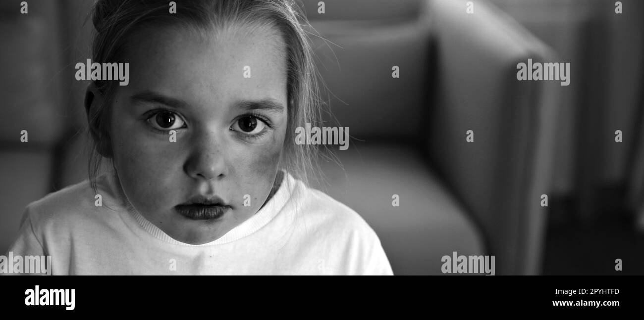 Petite fille avec des ecchymoses sur le visage à la maison, espace pour le texte. Victime de violence domestique. Bannière Banque D'Images