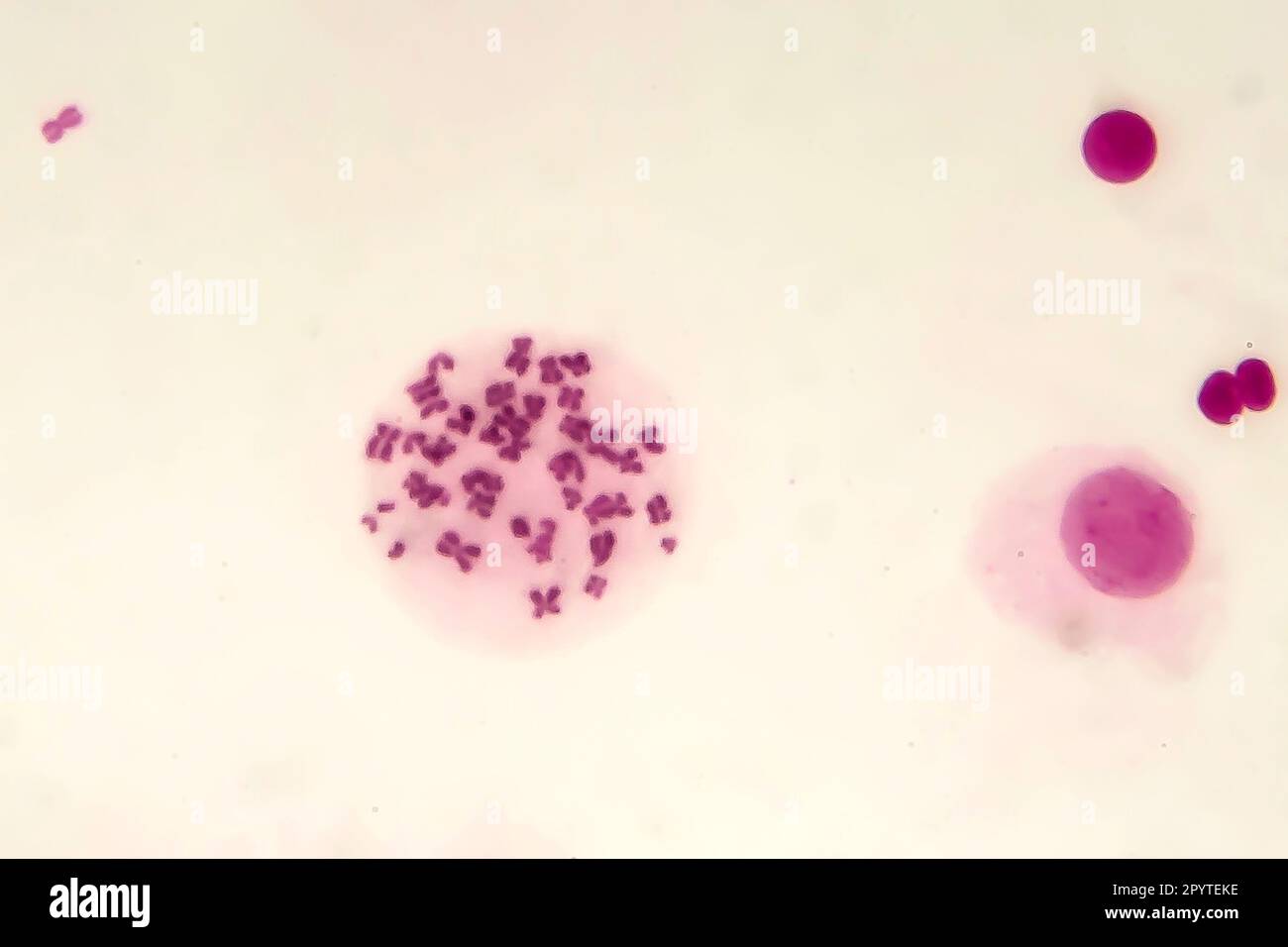Chromosomes mâles à l'intérieur de la cellule, photomicrographe léger Banque D'Images
