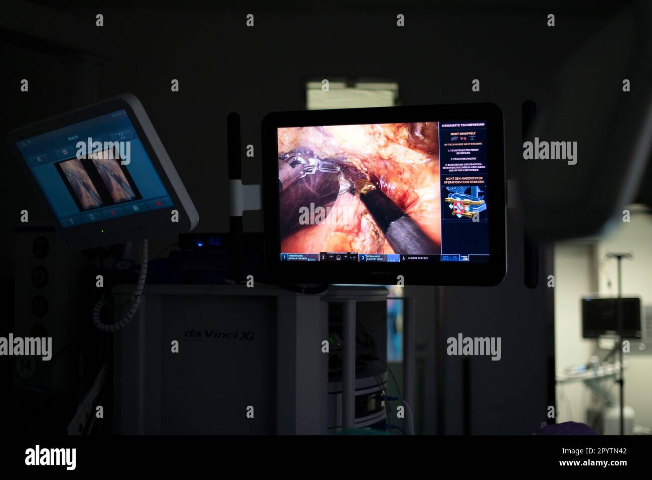 Chirurgie hybride moderne, 3D technologie innovante avec le système DaVinci une robotique KI de chirurgie assistée par robot. Opération d'une tumeur sur le foie et l'estomac à l'hôpital universitaire Carl Gustav Carus, clinique et polyclinique pour la chirurgie viscérale, la chirurgie thoracique et vasculaire et Centre pour les maladies tumorales à Dresde, Saxe, Allemagne. La chirurgie assistée par robot est une procédure chirurgicale moderne en médecine. Il permet au chirurgien de réaliser des techniques chirurgicales peu invasives avec le soutien du système assisté par robot Banque D'Images