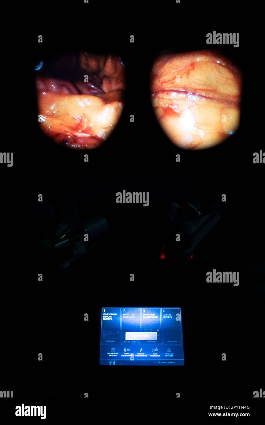 Chirurgie hybride moderne, 3D technologie innovante avec le système DaVinci une robotique KI de chirurgie assistée par robot. Opération d'une tumeur sur le foie et l'estomac à l'hôpital universitaire Carl Gustav Carus, clinique et polyclinique pour la chirurgie viscérale, la chirurgie thoracique et vasculaire et Centre pour les maladies tumorales à Dresde, Saxe, Allemagne. La chirurgie assistée par robot est une procédure chirurgicale moderne en médecine. Il permet au chirurgien de réaliser des techniques chirurgicales peu invasives avec le soutien du système assisté par robot Banque D'Images