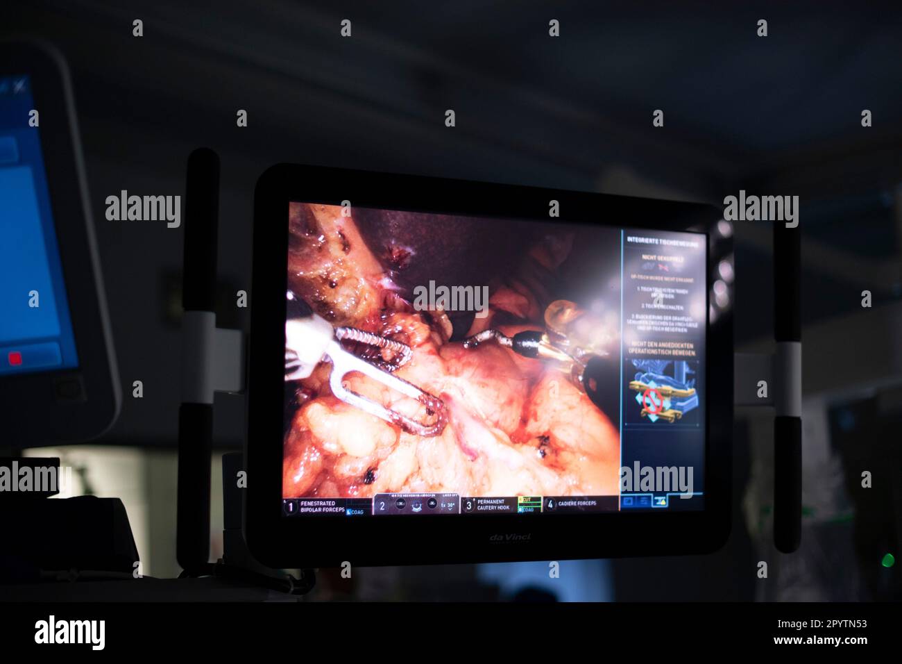 Chirurgie hybride moderne, 3D technologie innovante avec le système DaVinci une robotique KI de chirurgie assistée par robot. Opération d'une tumeur sur le foie et l'estomac à l'hôpital universitaire Carl Gustav Carus, clinique et polyclinique pour la chirurgie viscérale, la chirurgie thoracique et vasculaire et Centre pour les maladies tumorales à Dresde, Saxe, Allemagne. La chirurgie assistée par robot est une procédure chirurgicale moderne en médecine. Il permet au chirurgien de réaliser des techniques chirurgicales peu invasives avec le soutien du système assisté par robot Banque D'Images