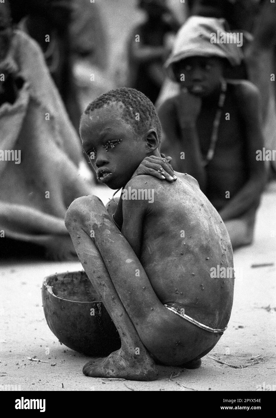 SDN , SOUDAN : Un garçon malnutris en proie à des mouches dans un centre d'alimentation de Waat dans le sud du Soudan 20.10.1992 Banque D'Images