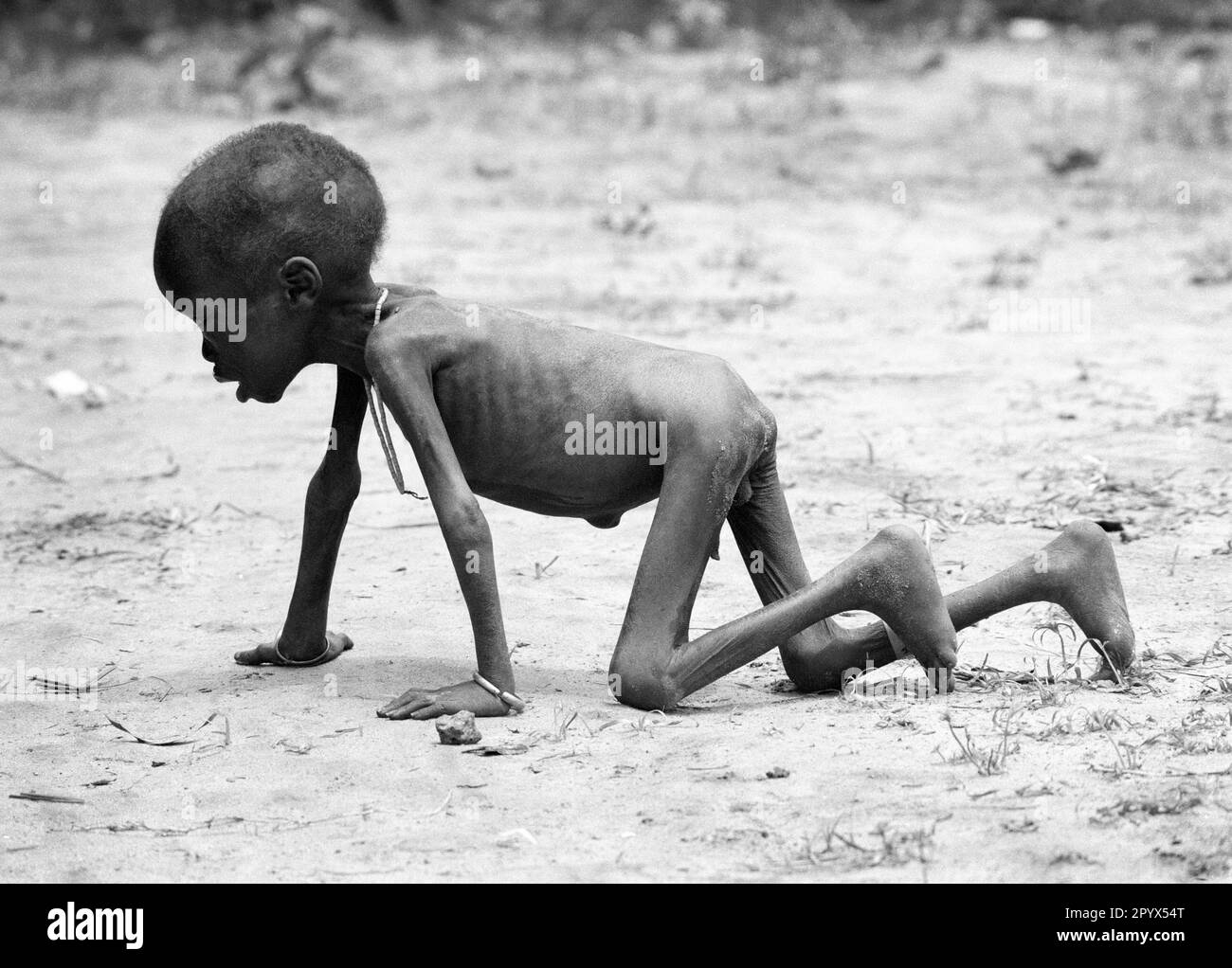 SDN , SOUDAN : Un garçon malnutris dans un centre d'alimentation d'Ayod dans le sud du Soudan 12.08.1993 Banque D'Images