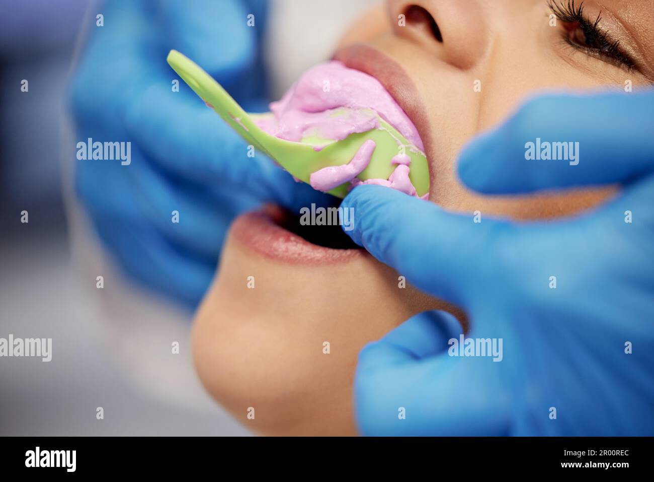 Trouver la solution idéale. une jeune femme ayant fait du travail dentaire sur ses dents. Banque D'Images