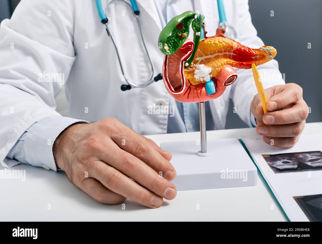 Traitement des maladies pancréatiques, pancréatites aiguës et chroniques. médecin montrant la maladie pancréatique sur le modèle médical anatomique du pancréas pour les analyses Banque D'Images
