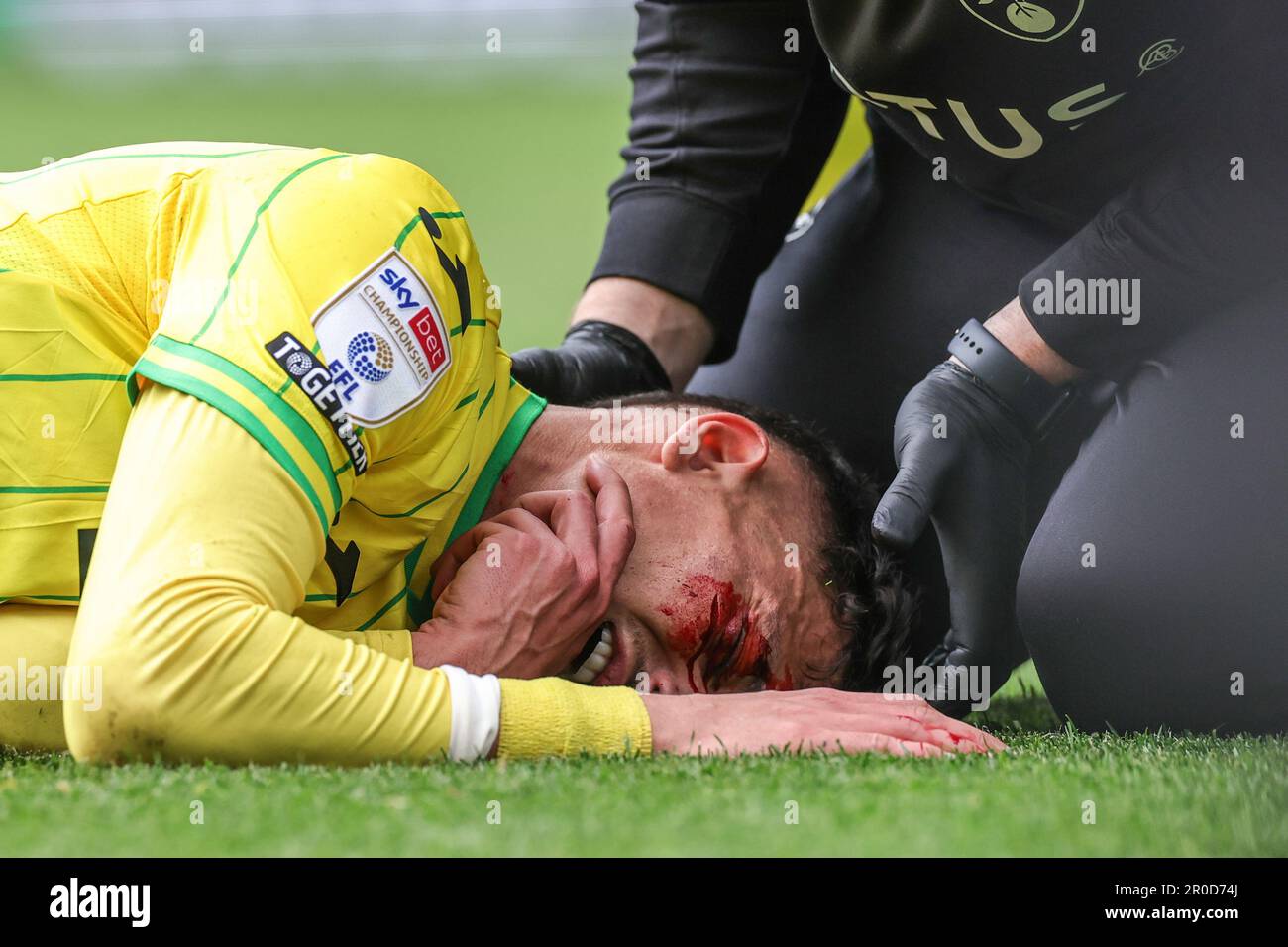 *** CONTENU GRAPHIQUE*** Dimitris Giannoulis #30 de la ville de Norwich reçoit une mauvaise coupe à sa joue lors du match de championnat de Sky Bet Norwich City vs Blackpool à Carrow Road, Norwich, Royaume-Uni, 8th mai 2023 (photo de Mark Cosgrove/News Images) Banque D'Images