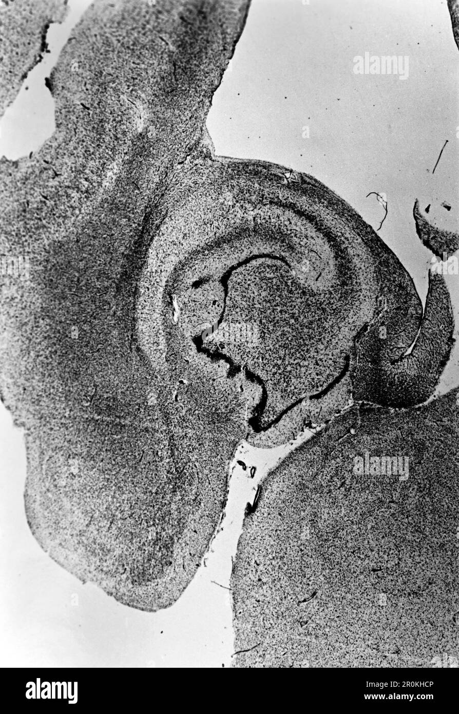 Ansicht eines Dünnschnitts durch ein Gehirn, 1938. Vue d'une section mince à travers un cerveau, 1938. Banque D'Images