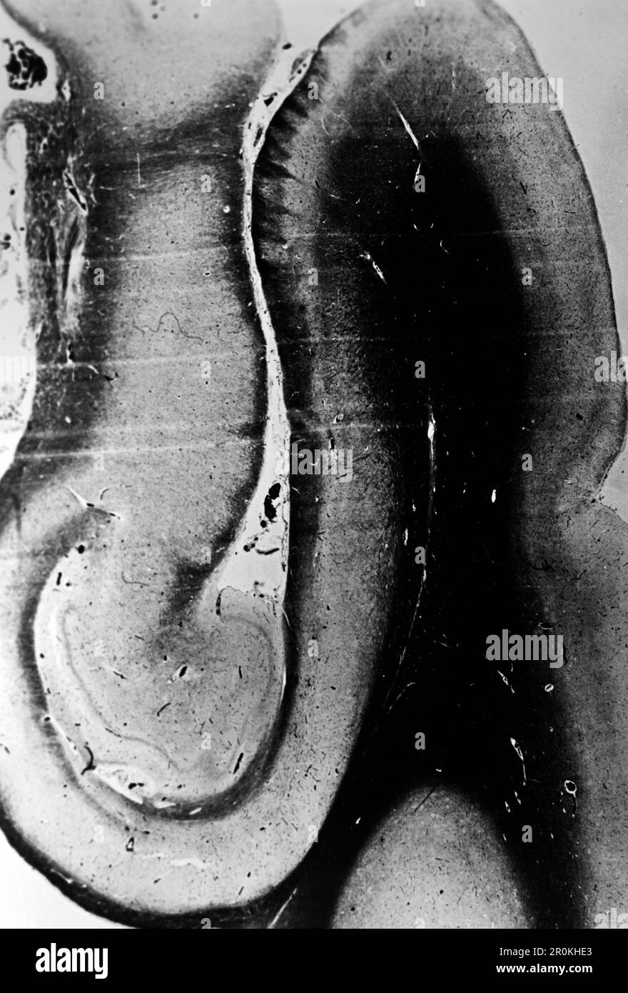 Ansicht eines Dünnschnitts durch ein Gehirn, 1938. Vue d'une section mince à travers un cerveau, 1938. Banque D'Images