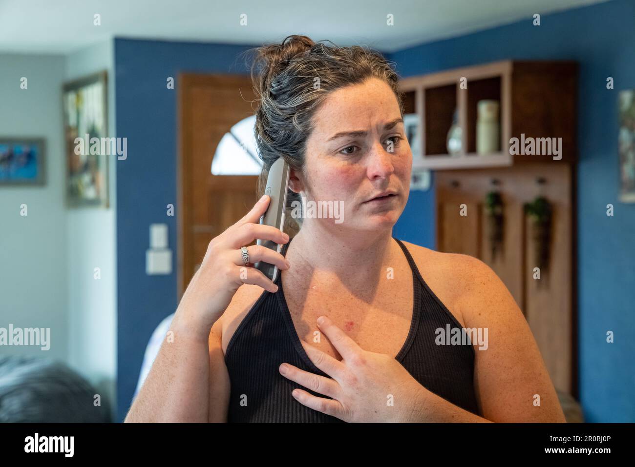 Une jeune femme appelle un médecin pour s'inquiéter du cancer de la peau du carcinome basocellulaire sur sa poitrine. Banque D'Images