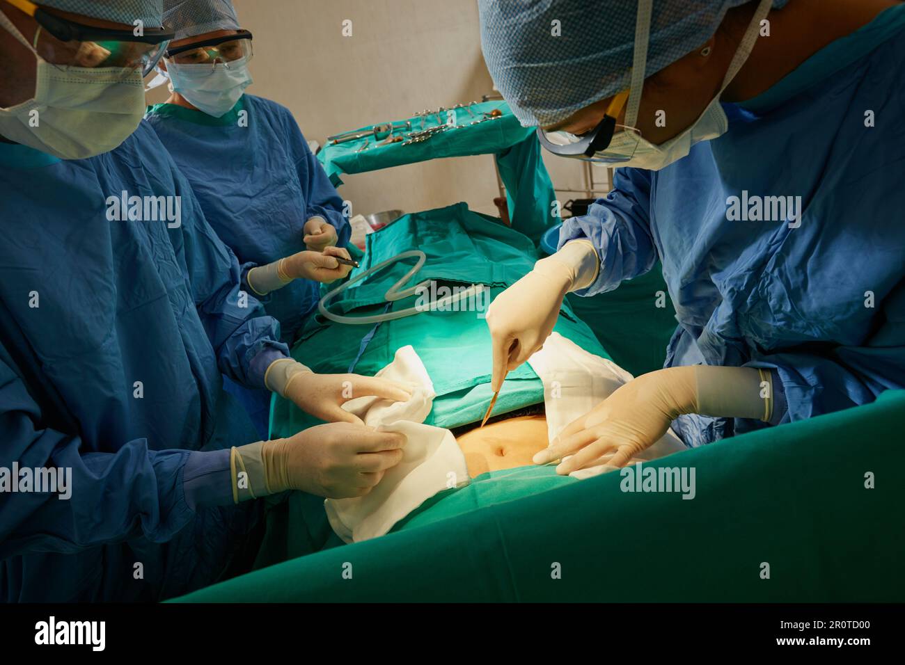 En cours de traitement chirurgical. un chirurgien effectuant une incision avec un scalpel sur un patient. Banque D'Images