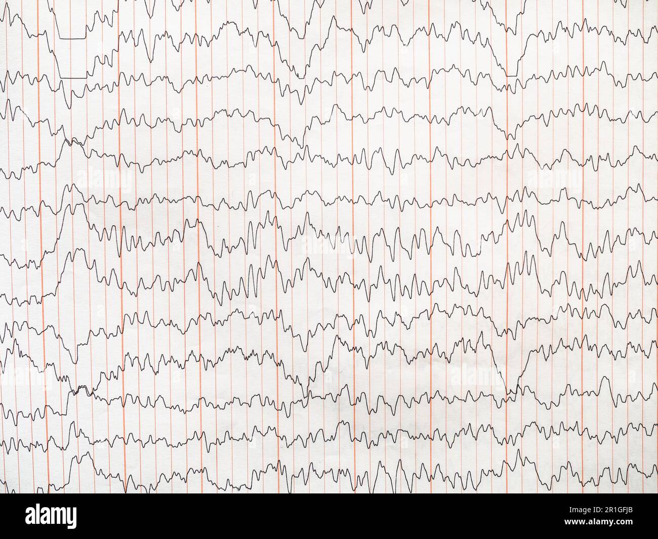 encéphalogramme sur papier - activité électrique du cerveau intégrée à l'amplitude Banque D'Images