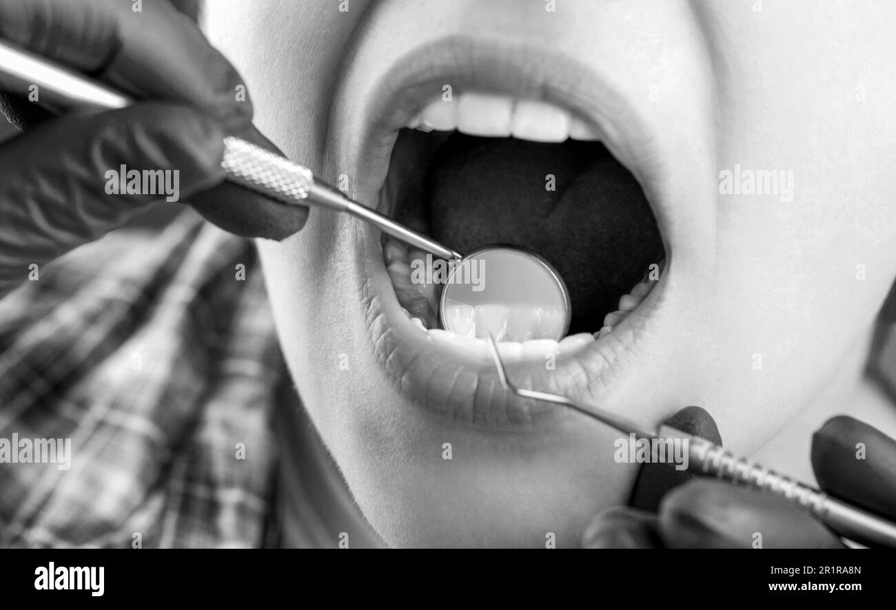 Concept de dents saines. Prendre soin des dents. Femme chez le dentiste. Soins dentaires, prendre soin des dents. Fille ayant des dents examinées chez des dentistes. Noir Banque D'Images