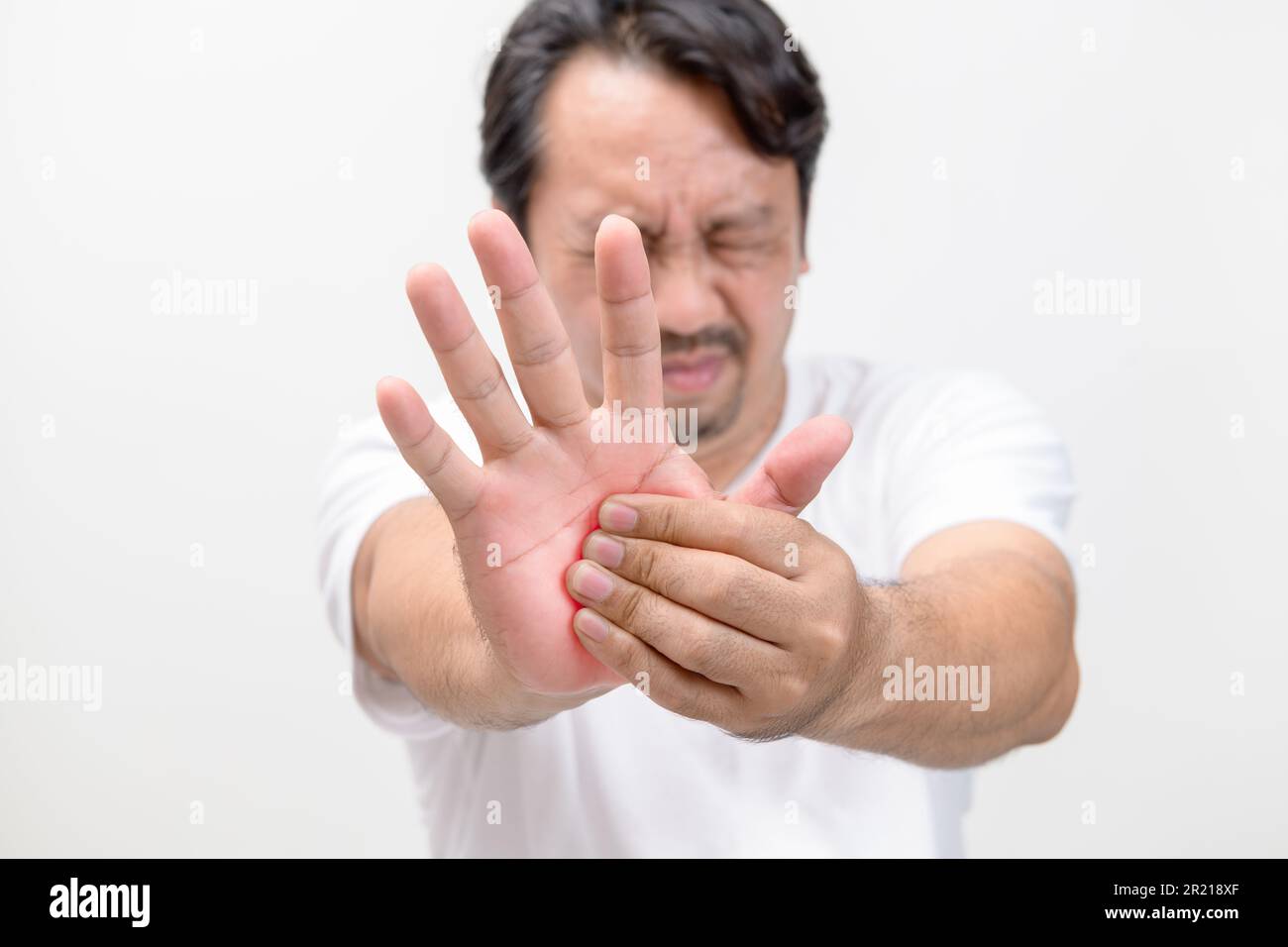 Douleur dans la paume. âge moyen souffrant de sa paume, homme massant la zone douloureuse, concept de soins de santé Banque D'Images