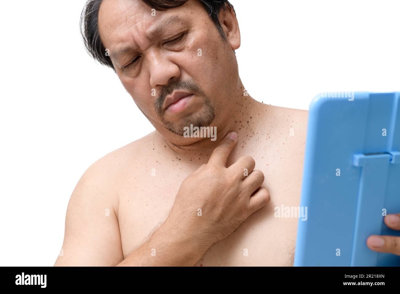 l'homme âgé d'âge moyen pointe vers des étiquettes de peau ou d'acrochordon sur son cou isolé sur fond blanc. Concept de soins de santé Banque D'Images