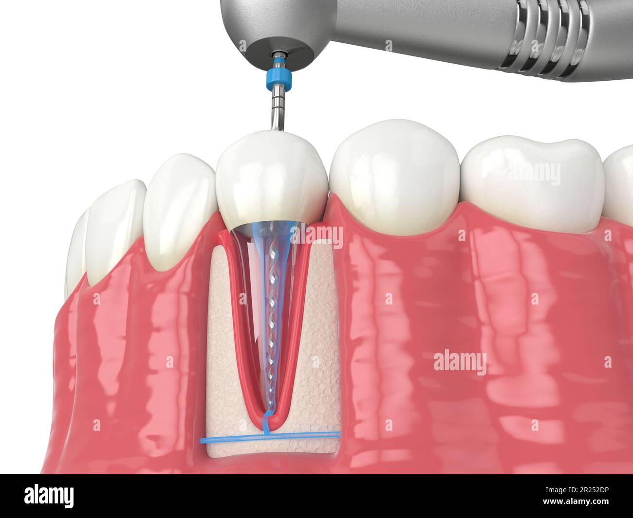 3d rendu de la mâchoire inférieure avec pièce à main et lime rotative endodontique sur fond blanc. Concept de traitement endodontique. Banque D'Images