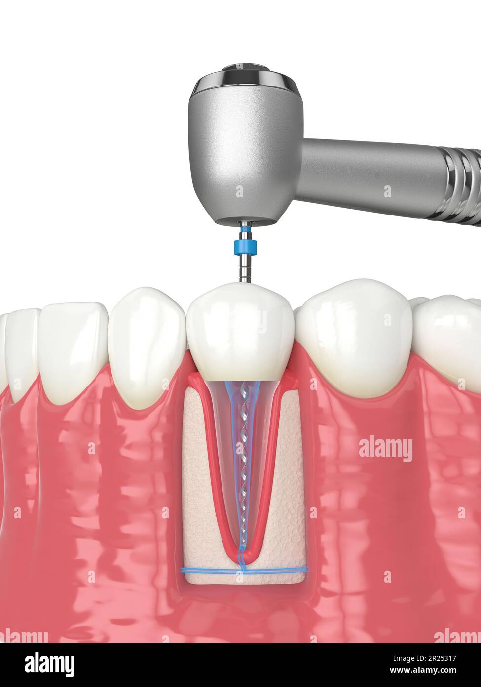 3d rendu de la mâchoire inférieure avec pièce à main et lime rotative endodontique sur fond blanc. Concept de traitement endodontique. Banque D'Images
