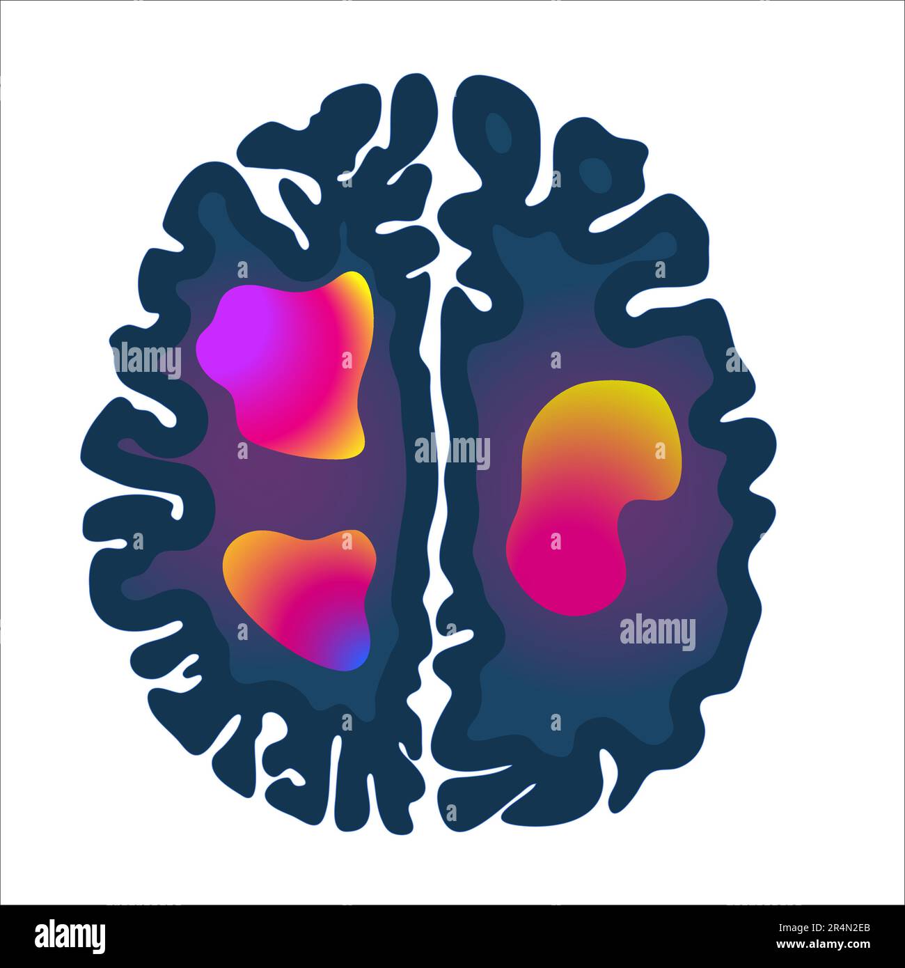 Icône d'image d'acquisition cérébrale IRM pour les diagnostics médicaux Illustration de Vecteur
