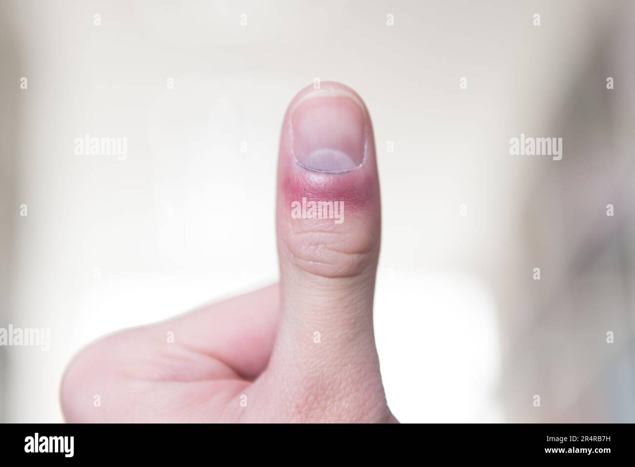 Homme souffrant de la main et du doigt dans Pain​ avec surlignage rouge Banque D'Images