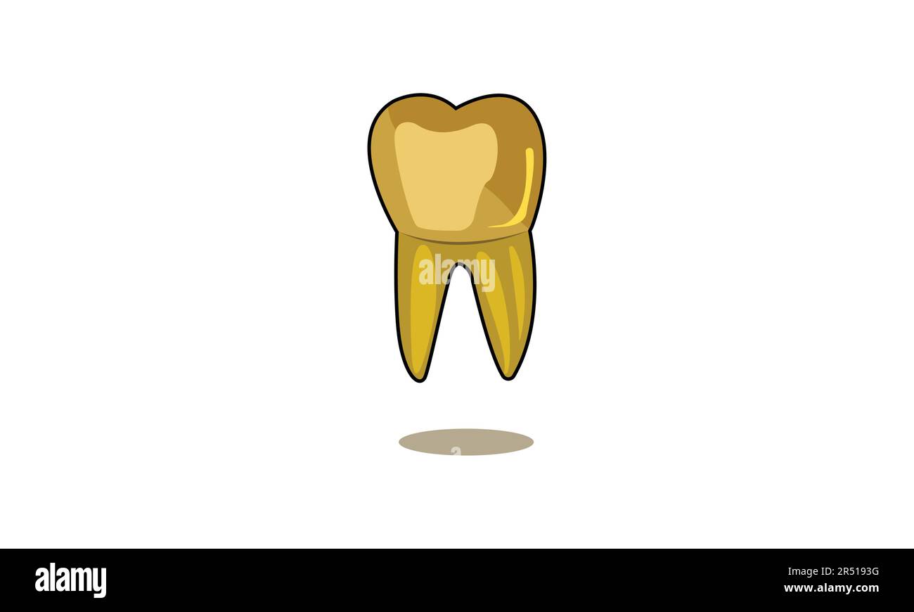 Couronnement doré sur les dents molaires Illustration de Vecteur