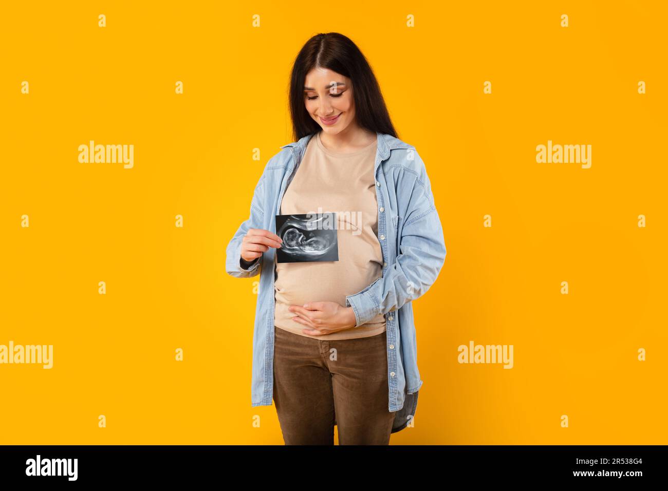 Jeune femme enceinte excitée embrassant le ventre et montrant une image échographique du bébé à naître sur le backgorund jaune Banque D'Images