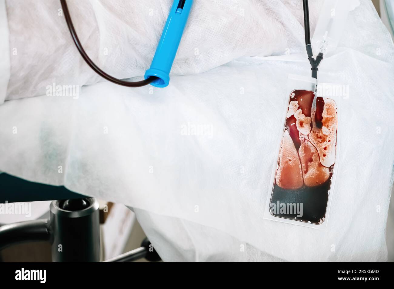 Poche de sang en laboratoire médical. Journée internationale du don de sang. Le donneur fait don de sang pour sauver la vie. Transfusion sanguine. Banque D'Images