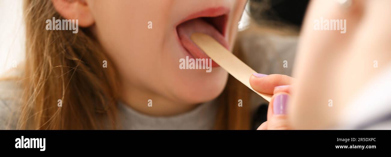 L'otorhinolaryngologiste examine une fillette atteinte d'un mal de gorge Banque D'Images