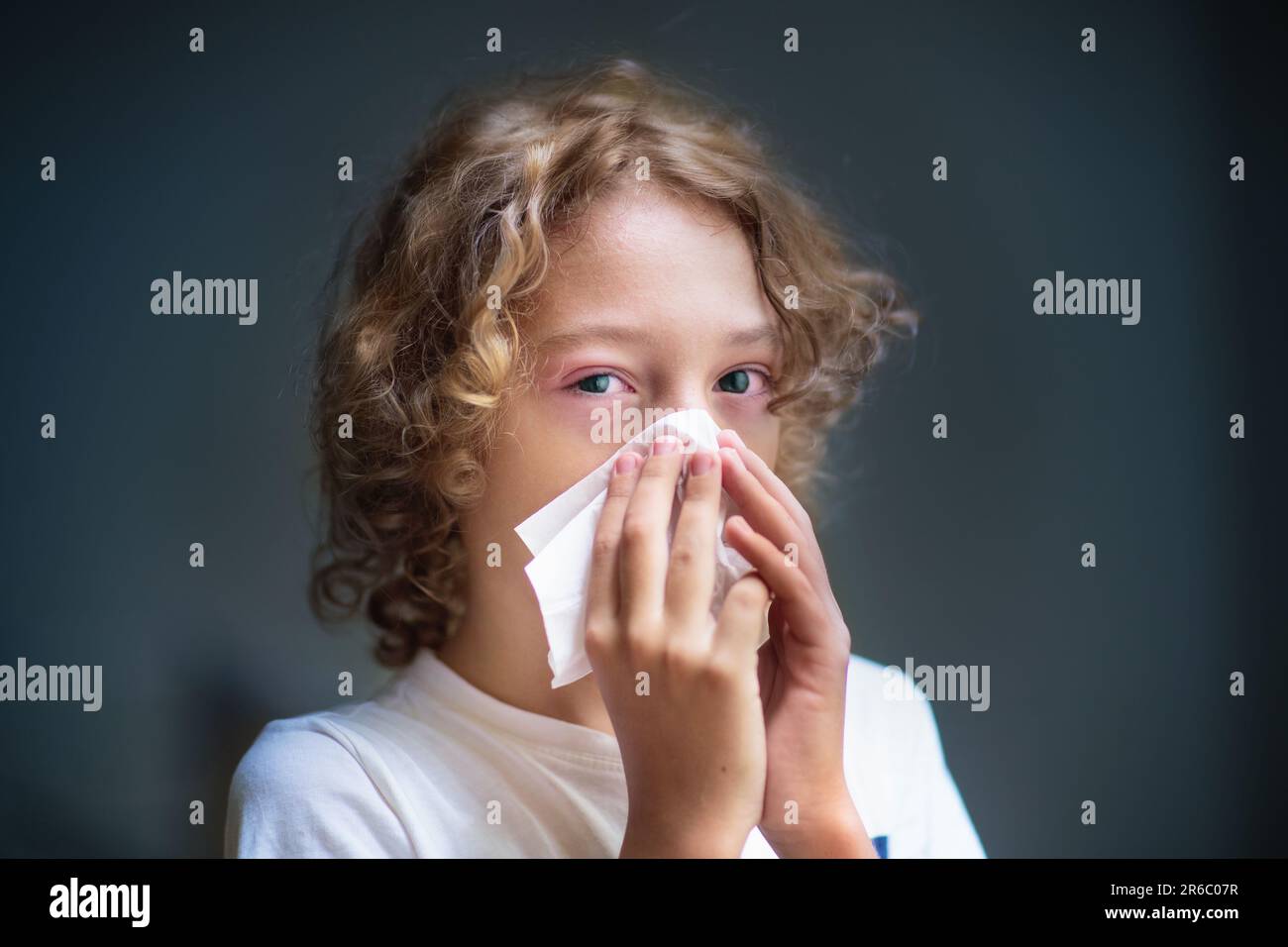 Enfant avec oeil rose gonflé. Infection des yeux et allergie au pollen. Petit garçon allergique avec écoulement nasal et yeux rouges. Enfant malade chez le médecin ou à l'hôpital. Banque D'Images