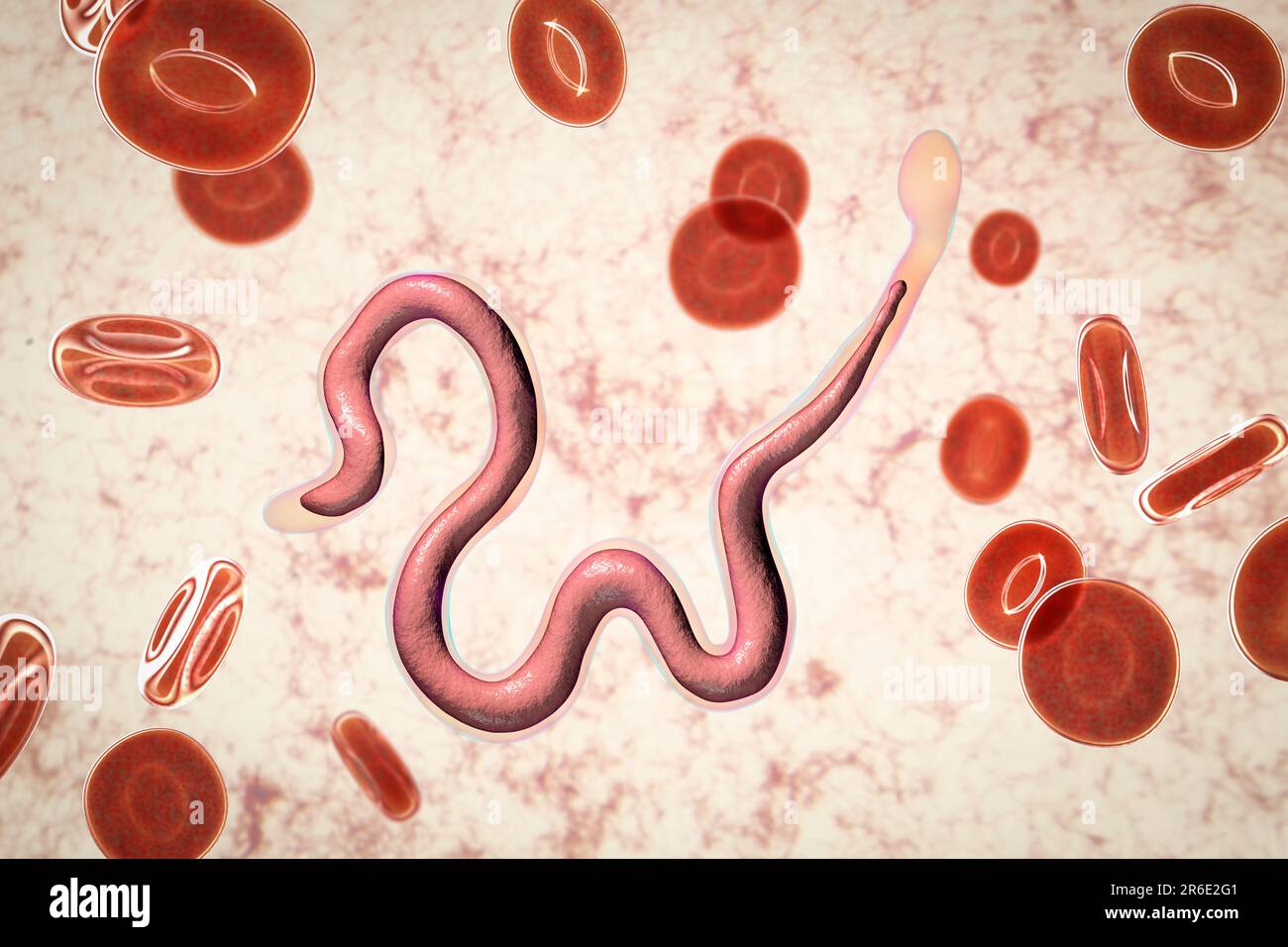 Brugia malayi ordinateur illustration d'un ver nématode parasitaire et cause des droits de la filariose lymphatique (éléphantiasis). Brugia malayi est l'un des cinq Banque D'Images