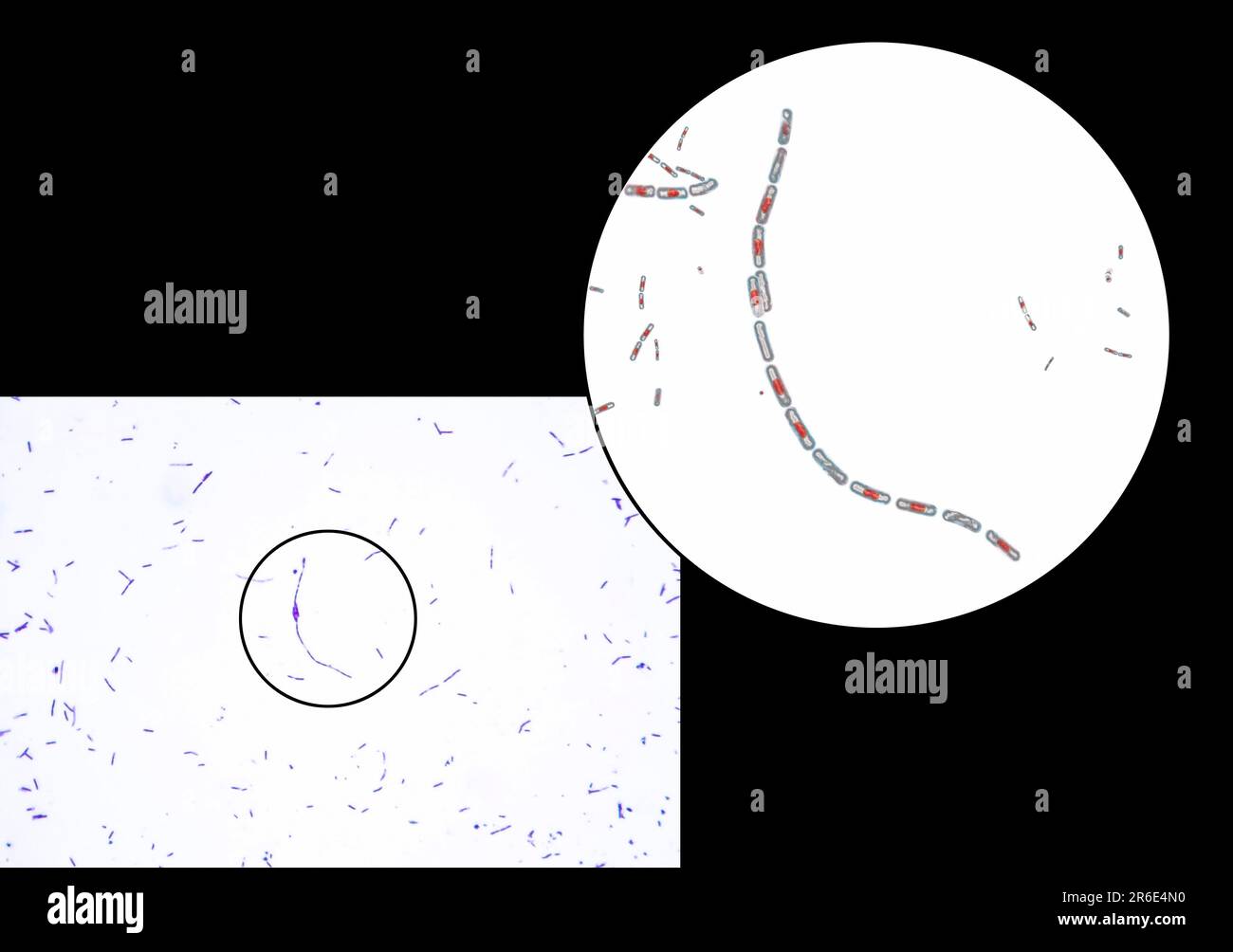 Bactéries anthrax, micrographe léger et illustration informatique. La bactérie de l'anthrax (Bacillus anthracis) est la cause de la maladie de l'anthrax chez les humains et Banque D'Images