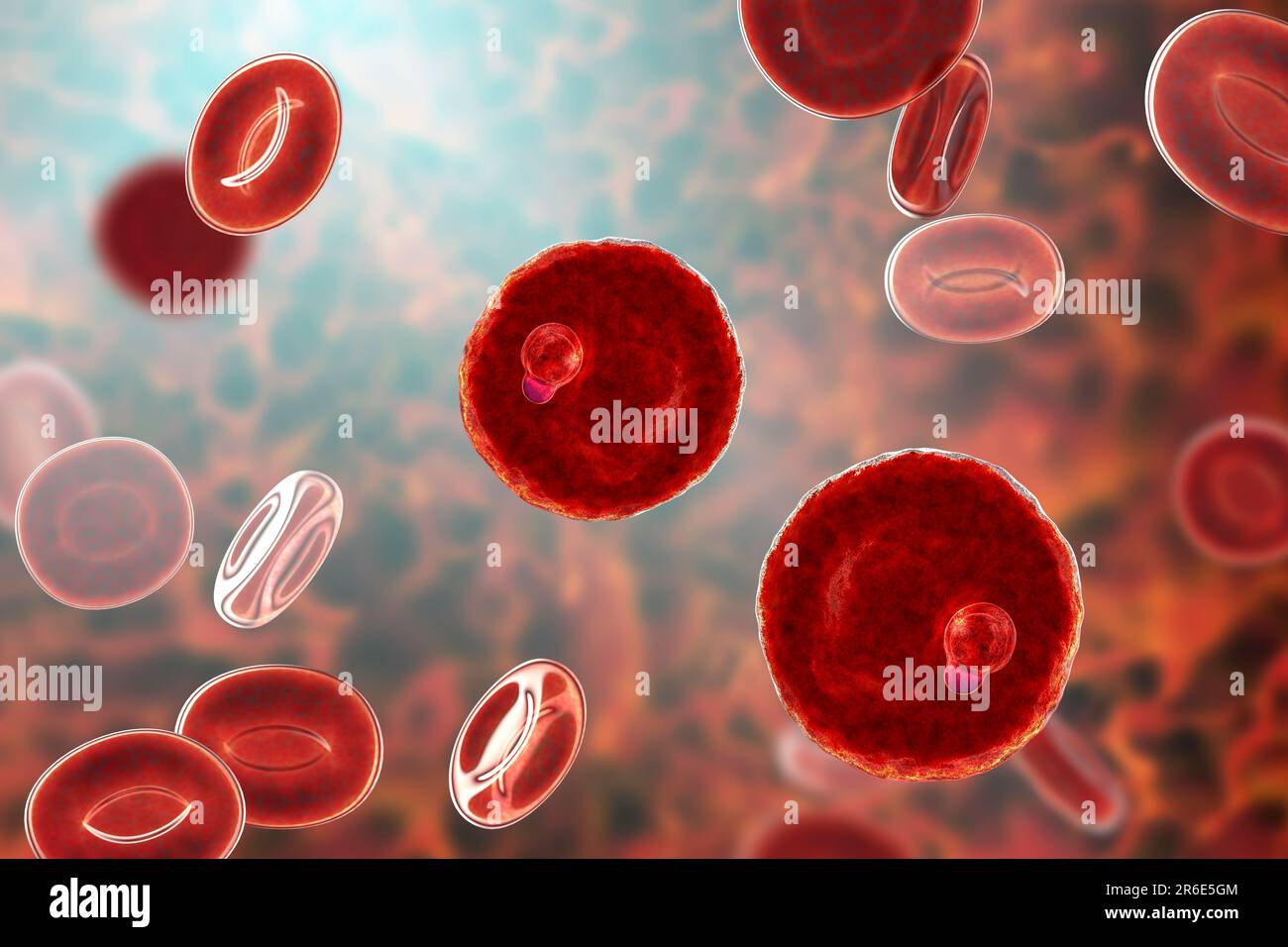 Protozoaire Plasmodium malariae à l'intérieur des globules rouges, illustration informatique. P. malariae est l'agent causal du Quartan Malaria, également connu sous le nom de malarique M. Banque D'Images