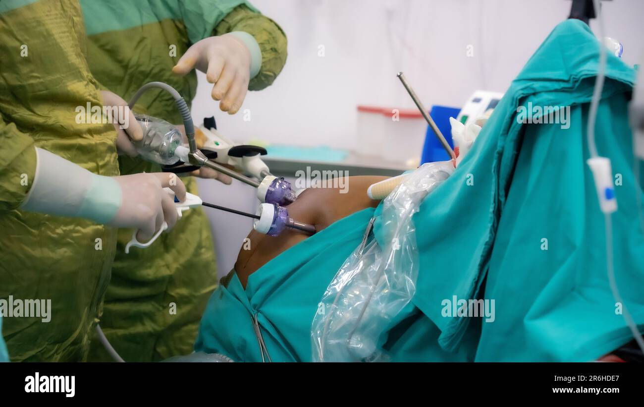 Chirurgie de l'obésité. Chirurgie de perte de poids avec la technique
