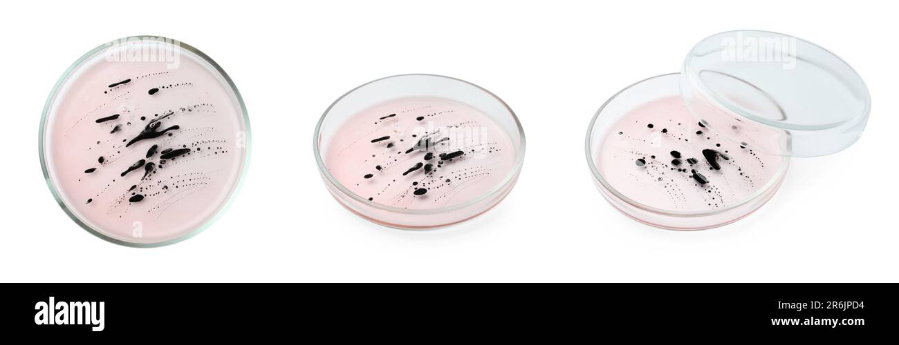 Collage de boîtes de Petri avec culture sur fond blanc, angles différents Banque D'Images