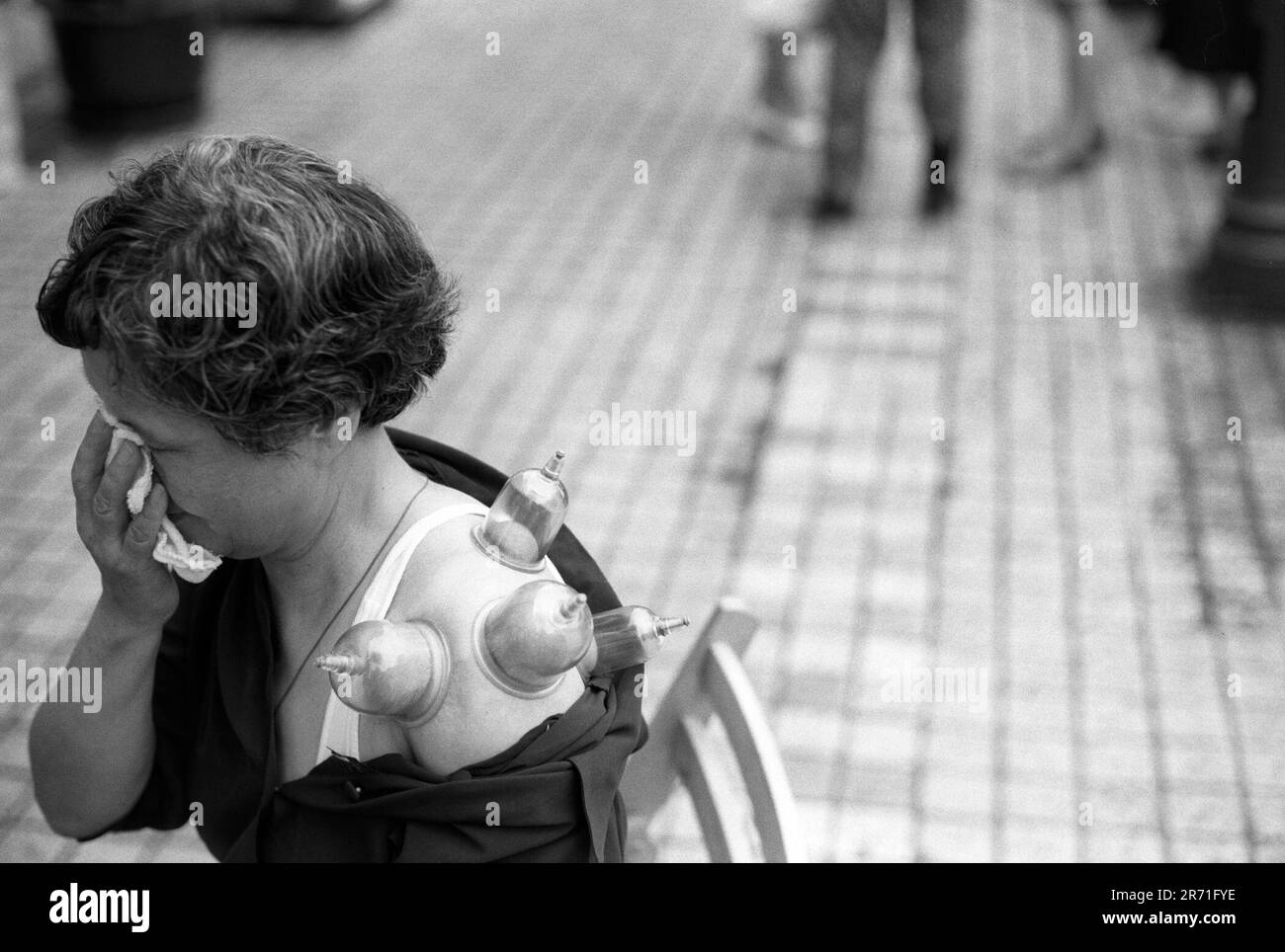 Shanghai Chine 2000. Les visiteurs de Shanghai ont toujours commenté le large éventail d'activités qui vont à l'extérieur dans la rue; tout est à trouver y compris la médecine traditionnelle chinoise. Ici, des ventouses de verre sont placées sur les épaules et le dos de ce rhumatisme sufferer pour tirer hors de l'énergie négative: Le feu et le mauvais sang. 2000s HOMER SYKES Banque D'Images