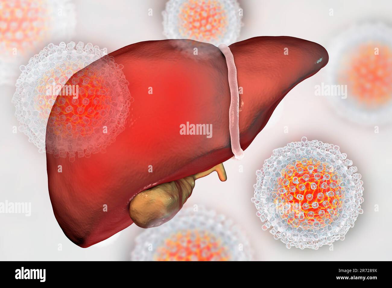 Hepatitis B Virus Particles Banque De Photographies Et D’images à Haute ...