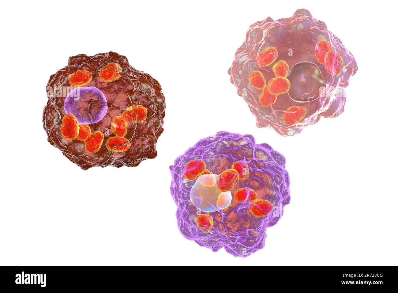 Amastigotes de Leishmania parasites à l'intérieur des macrophages, œuvres d'art. Leishmania sp. causer la leishmaniose, une maladie tropicale transmise par des morsures de l'infé Banque D'Images