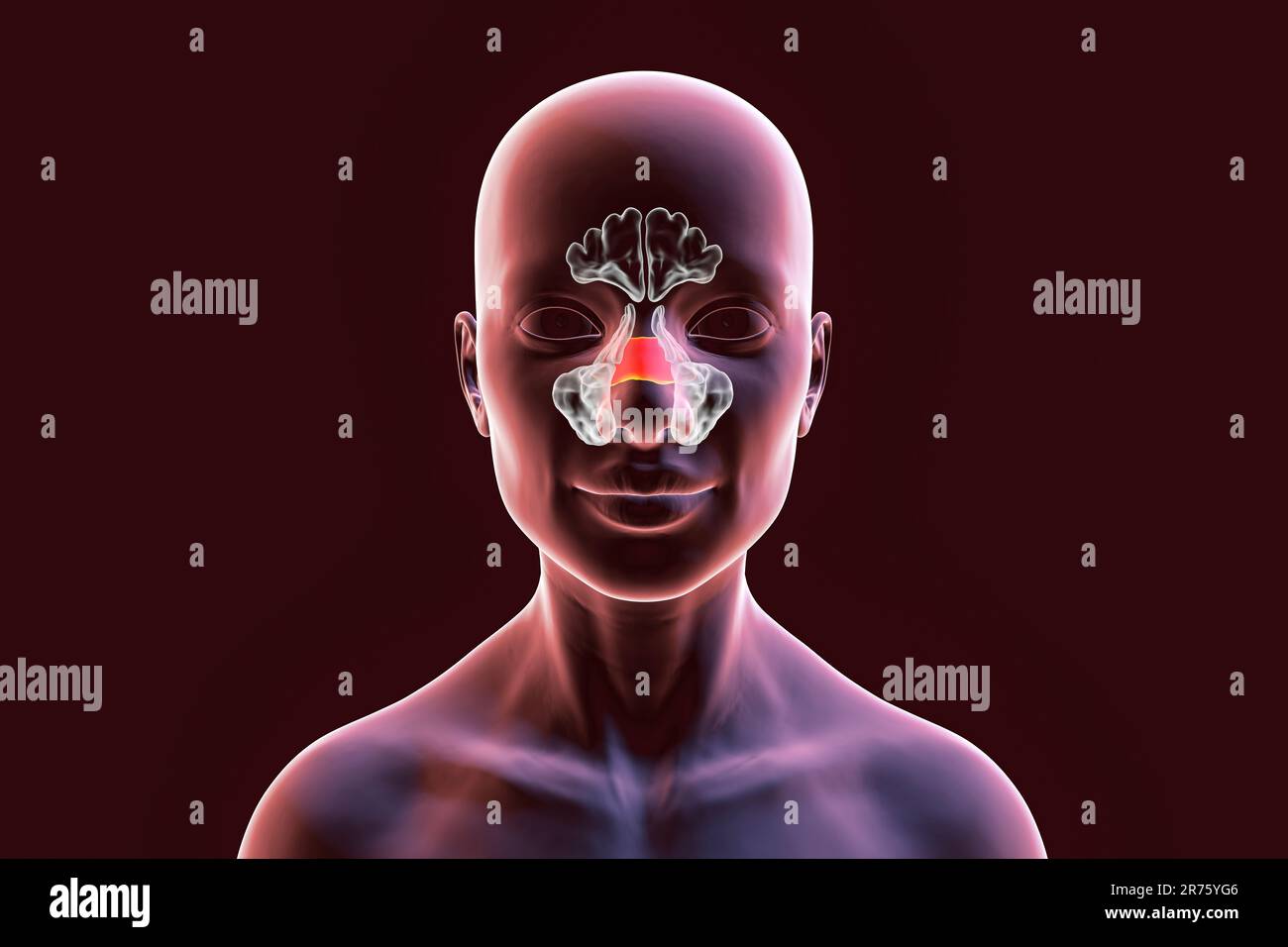 Sinus paranasaux humains, illustration informatique. Les sinus sont des espaces remplis d'air et bordés de membrane dans les os du visage. Les sinus frontaux sont abo Banque D'Images