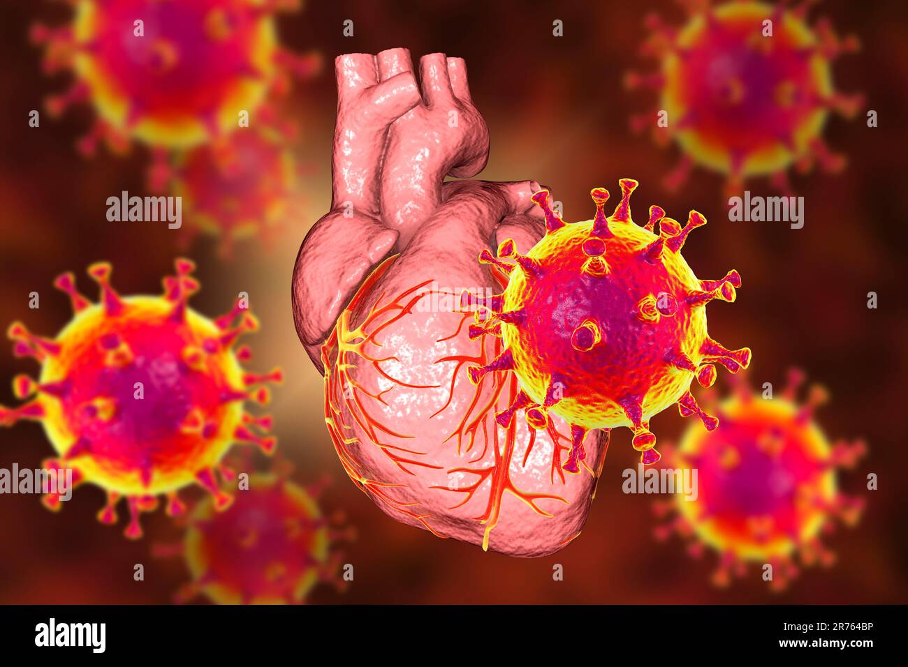 Virus COVID-19 affectant le cœur, illustration conceptuelle 3D. L'inflammation du coeur et d'autres organes peut être une complication de Covid-19, une resp Banque D'Images