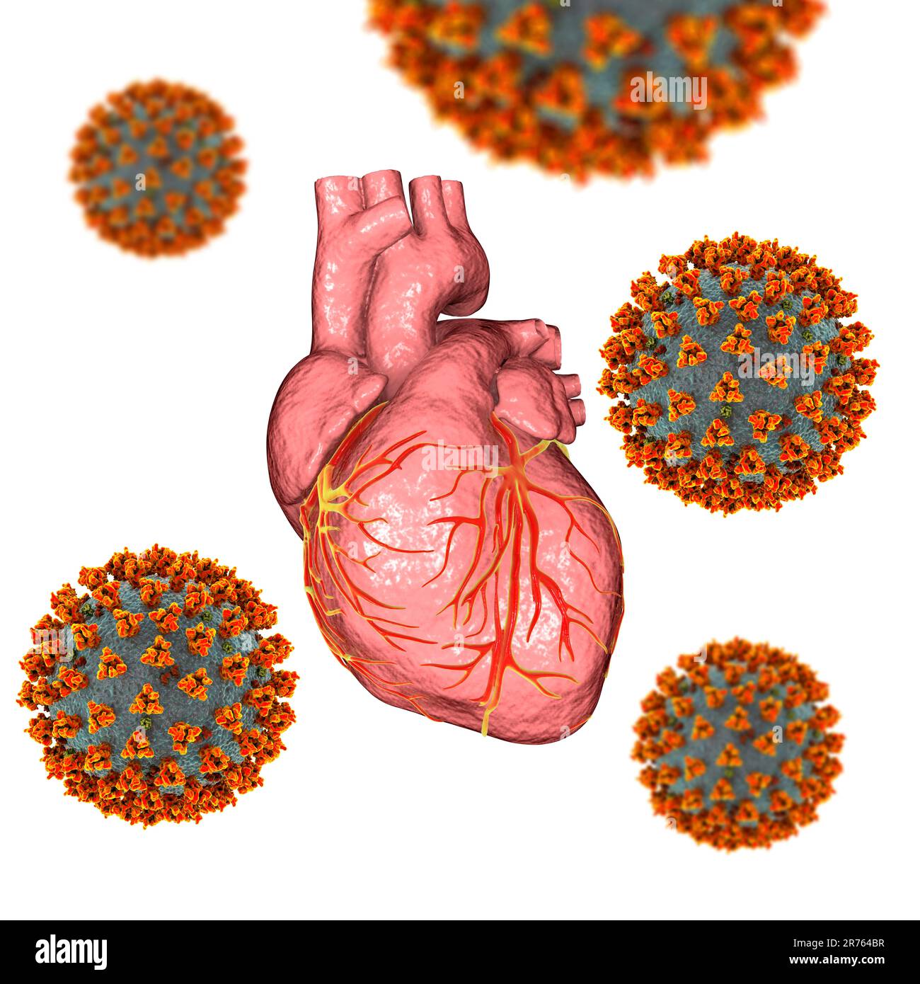Virus COVID-19 affectant le cœur, illustration conceptuelle 3D. L'inflammation du coeur et d'autres organes peut être une complication de Covid-19, une resp Banque D'Images