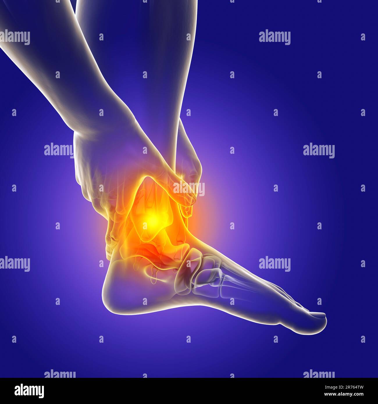 Douleur au pied et à la cheville, illustration informatique conceptuelle. Douleur au talon d'Achille. Banque D'Images