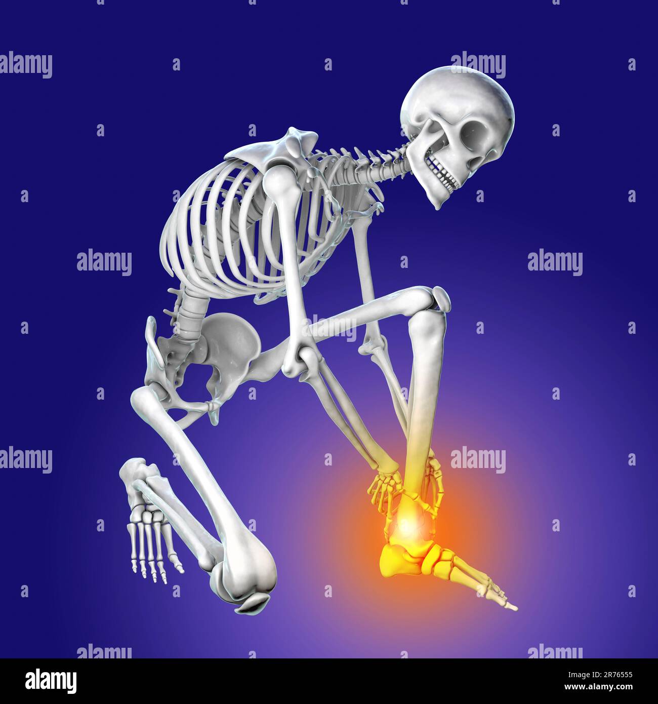 Douleur au pied et à la cheville, illustration informatique conceptuelle. Douleur au talon d'Achille. Banque D'Images