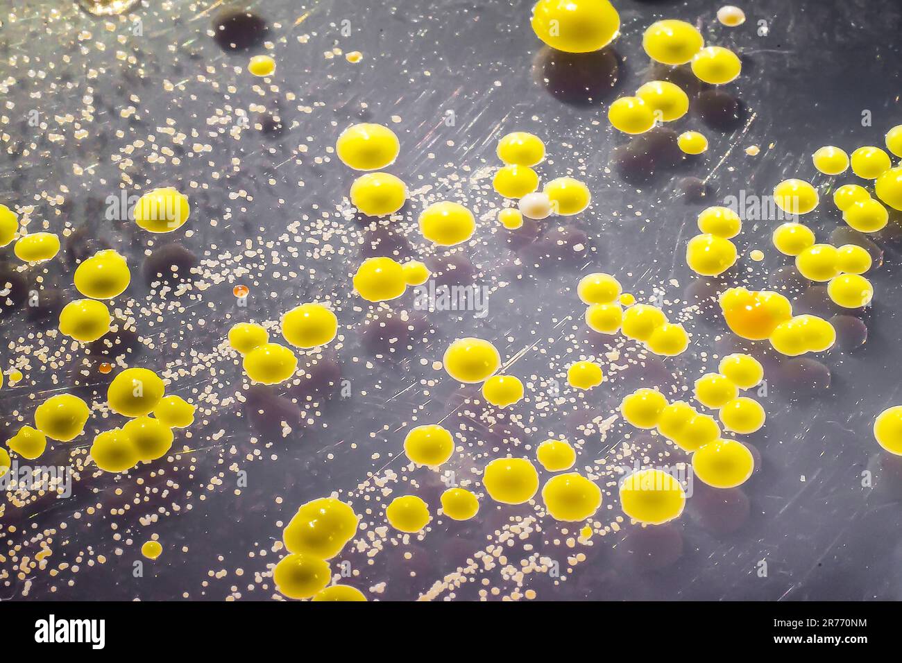 Bactéries cultivées à partir d'un frottis cutané, colonies de Micrococcus luteus et de Staphylococcus epidermidis sur gélose trypticase soja. Banque D'Images