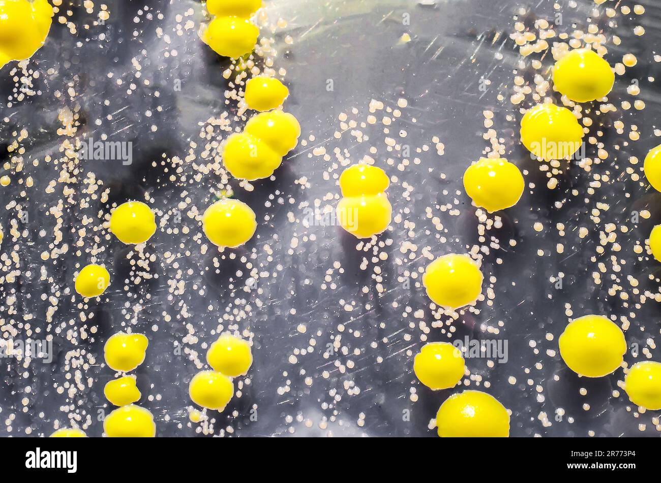 Bactéries cultivées à partir d'un frottis cutané, colonies de Micrococcus luteus et de Staphylococcus epidermidis sur gélose trypticase soja. Banque D'Images