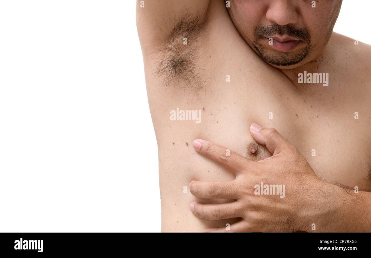 Gros plan sur les étiquettes de la peau de l'homme sous les aisselles et les côtés du corps isolé sur fond blanc, concept de peau de soins de santé Banque D'Images