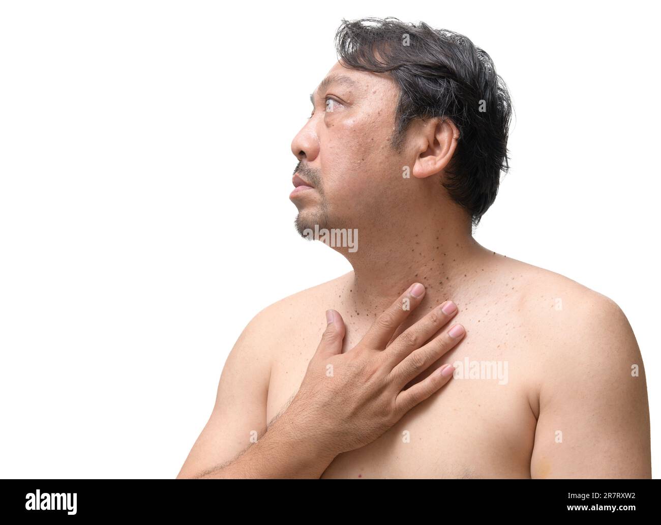 L'homme âgé d'âge moyen d'Asie pointe vers des étiquettes de peau ou d'acrochordon sur son cou isolé sur fond blanc. Concept de soins de santé Banque D'Images