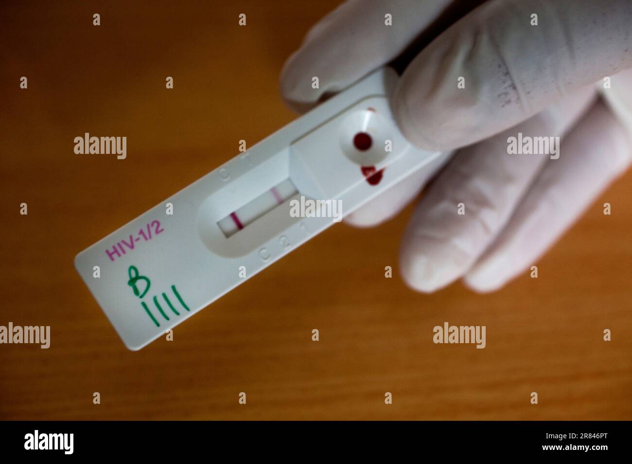 Test : deux lignes rouges et le test est positif pour le VIH. Banque D'Images