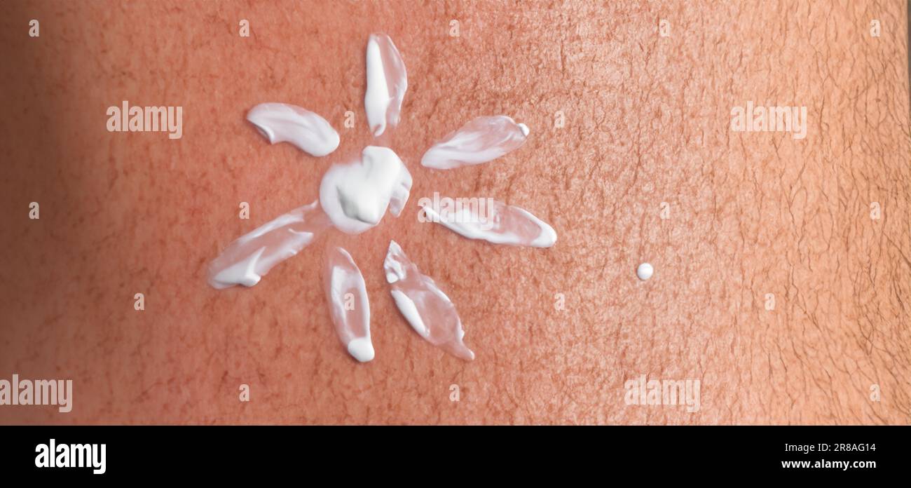 Gros plan de la protection solaire ou de la crème solaire sur la peau humaine. Soins de la peau