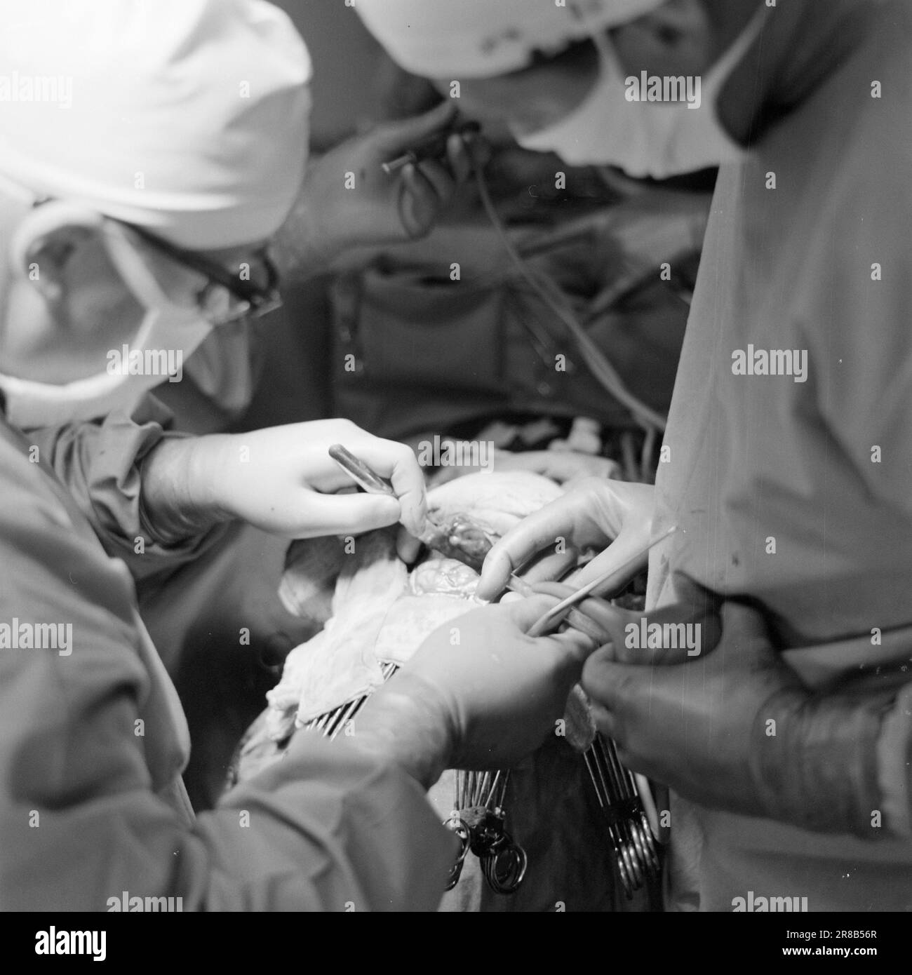 Courant 16-9-1960: Un aperçu dans le cerveau pendant cinq heures le chirurgien se tenait près de la tête du patient. Deuxième par seconde les heures tickées par - et pas l'un d'entre eux pouvait se reposer, parce qu'un homme lui avait confié sa vie. Les employés d'Aktuell ont été autorisés à suivre l'opération qui a été effectuée à Rikshospitalet à Oslo. La préparation libre de la partie malade du cerveau avec la malformation des vaisseaux sanguins est en cours. Des pinces argentées sont placées sur les vaisseaux sanguins pour éviter les saignements. Ici, la malformation de la veine a presque été desserrée et la phase la plus agitée de l'opératio Banque D'Images