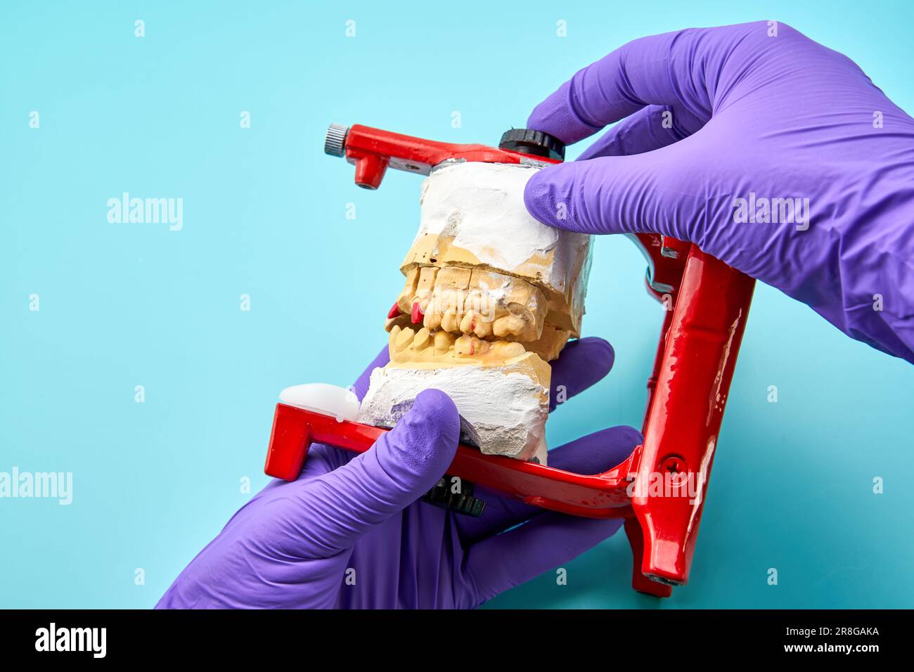 Prosthodontics tenant une prothèse dentaire dans l'ofice dentaire Banque D'Images